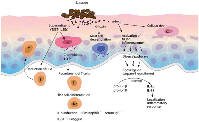 Scratching the surface: the skin microbiome and atopic dermatitis ...